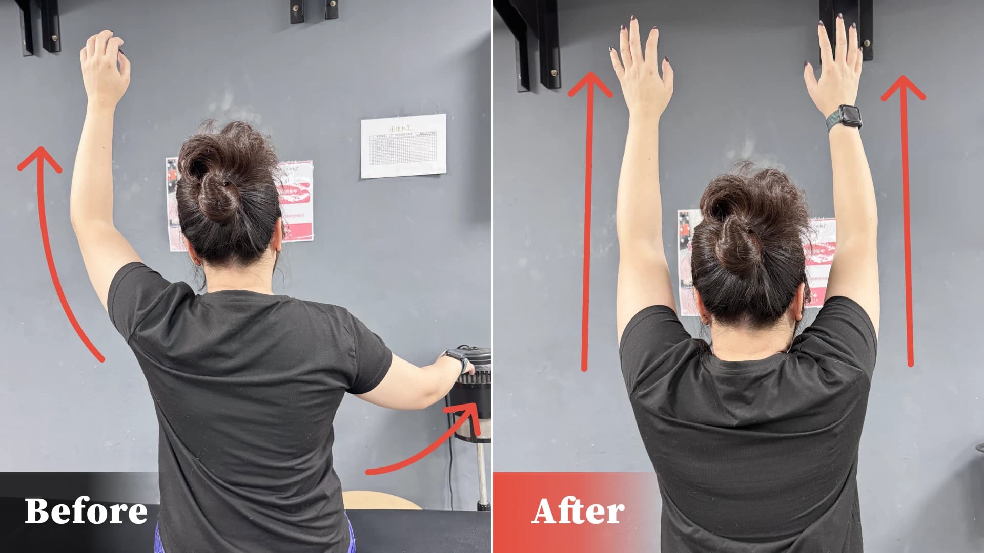 改善肩關節活動度